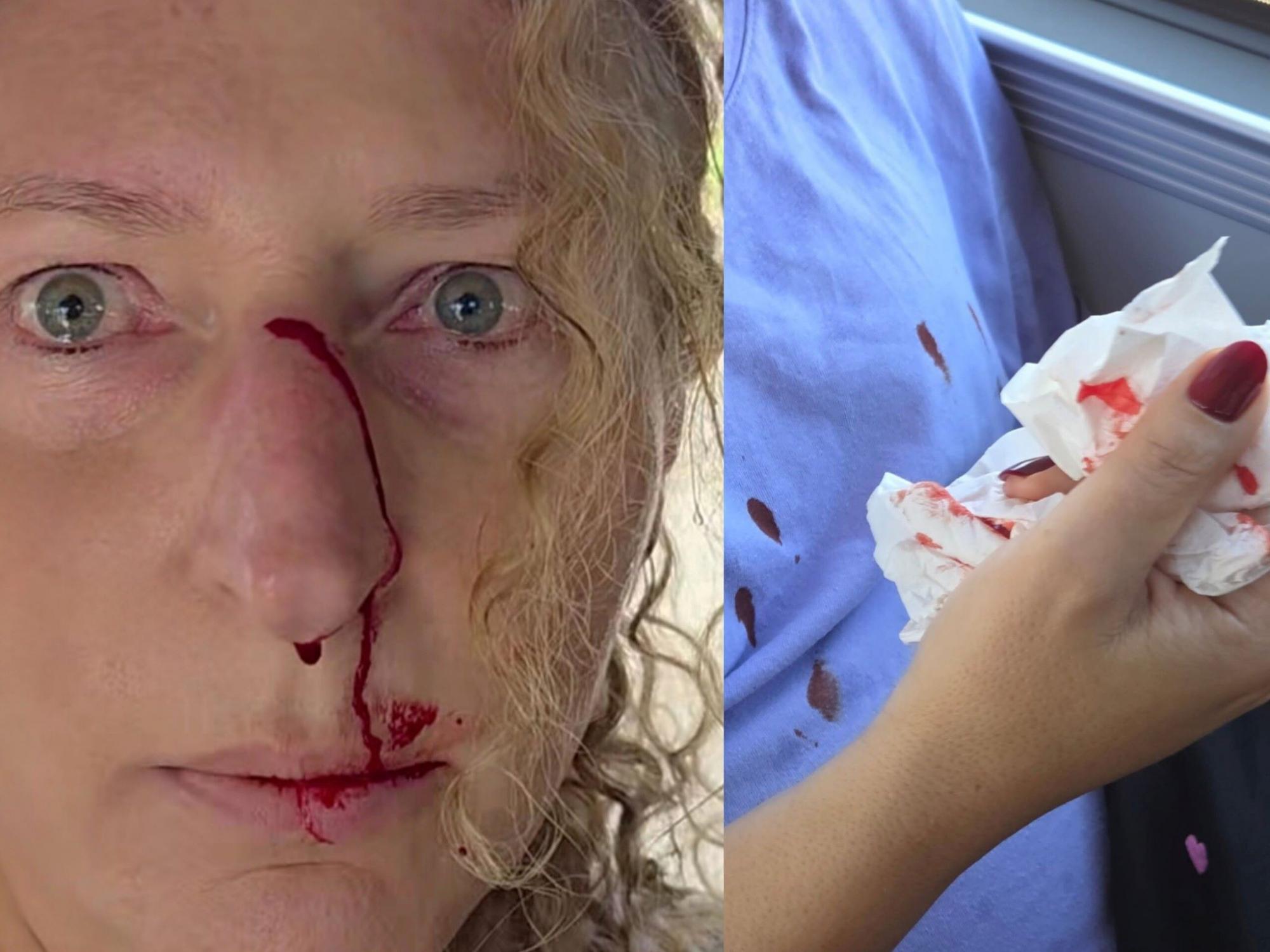 У Варшаві чоловік напав на правозахисницю, яка заступилася за українку в автобусі